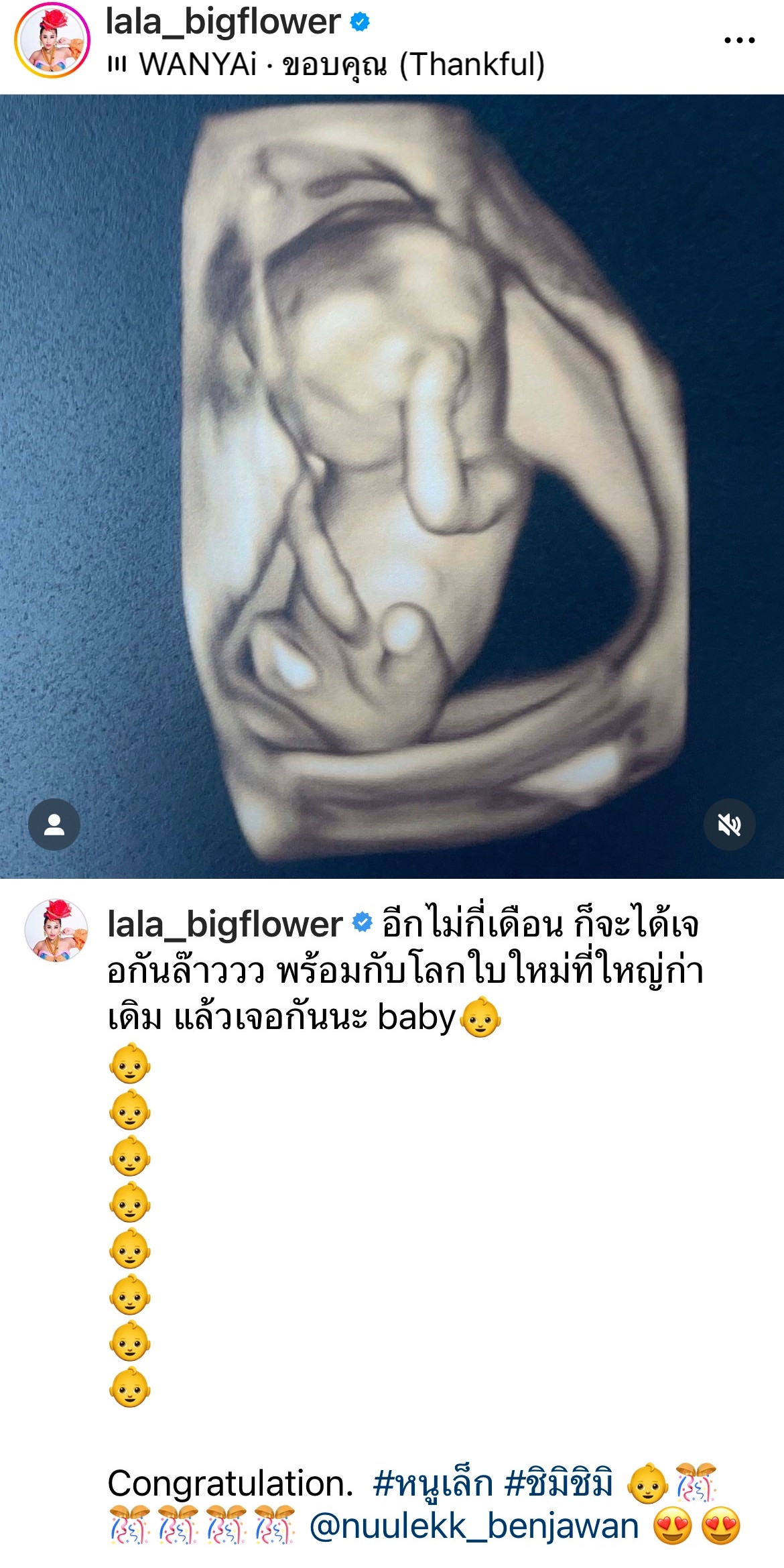 ลาล่า ประกาศข่าวดี หนูเล็ก บลูเบอร์รี่ พร้อมโชว์ภาพอัลตร้าซาวด์