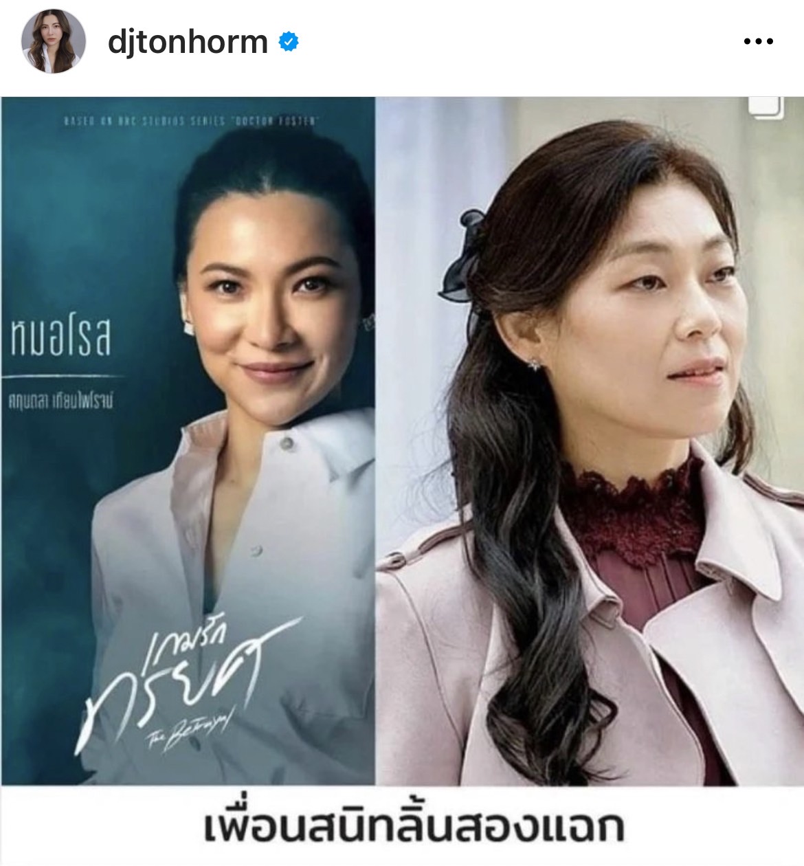 ต้นหอม ยอมรับกลัวคนเกลียด หลังต้องรับบทบาทนี้?? ต้นหอม ยอมรับกลัวคนเกลียด หลังต้องรับบทบาทนี้??