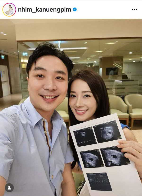 หนิม คนึงพิมพ์ ปล่อยภาพพรีเวดดิ้ง นับถอยหลัง2วีค เข้าพิธีวิวาห์พร้อมลูกในครรภ์ หนิม คนึงพิมพ์ ปล่อยภาพพรีเวดดิ้ง นับถอยหลัง2วีค เข้าพิธีวิวาห์พร้อมลูกในครรภ์