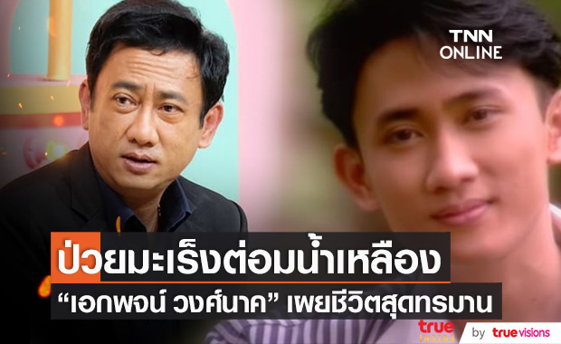 อดีตนักร้องลูกทุ่ง "เอกพจน์ วงศ์นาค" ป่วยมะเร็งต่อมน้ำเหลือง เผยชีวิตสุดทรมาน
