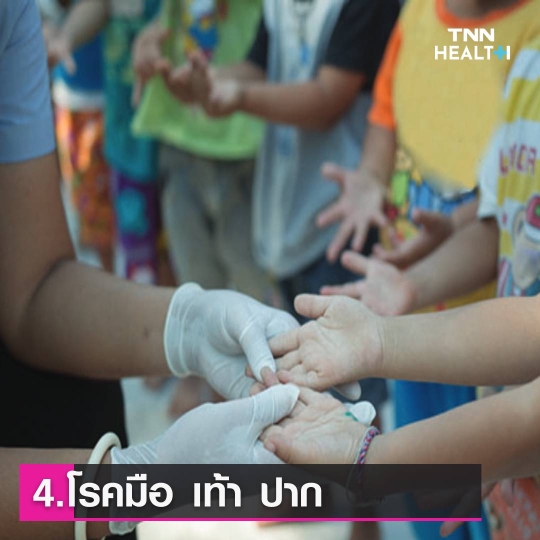 ุ6 โรคมาพร้อมฤดูฝน ป้องกันไว้ก่อนเจ็บป่วย ุ6 โรคมาพร้อมฤดูฝน ป้องกันไว้ก่อนเจ็บป่วย