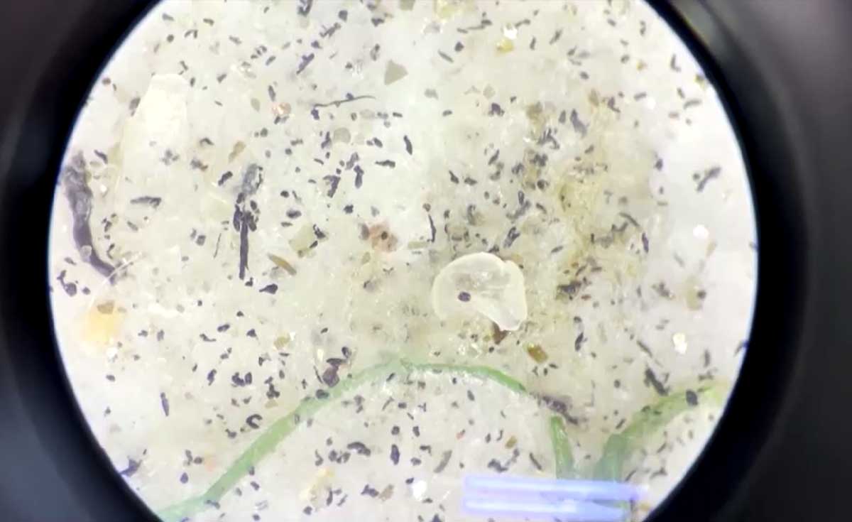 นักวิจัยพบไมโครพลาสติกปนเปื้อนในกระแสเลือดมนุษย์ครั้งแรก นักวิจัยพบไมโครพลาสติกปนเปื้อนในกระแสเลือดมนุษย์ครั้งแรก