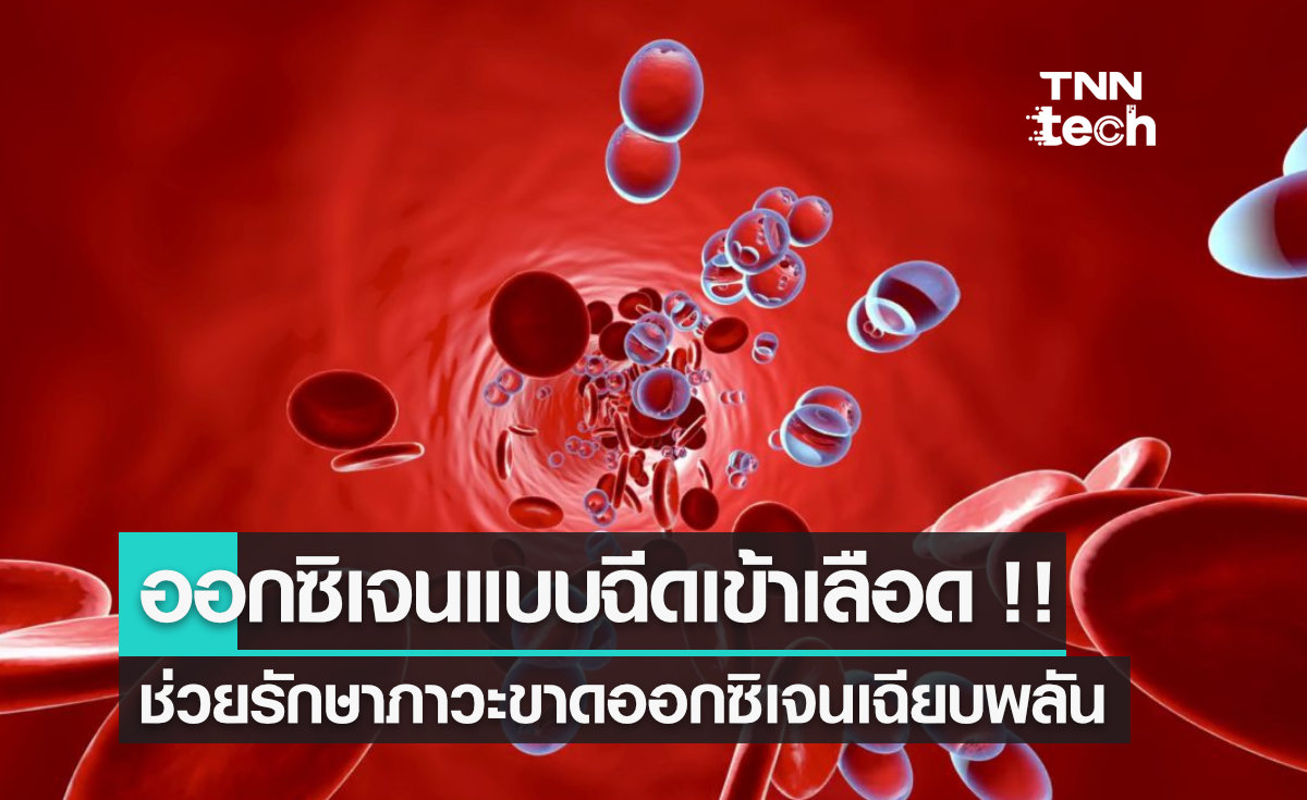 นักวิทยาศาสตร์คิดค้น "ออกซิเจนแบบฉีดเข้าเลือด" ช่วยรักษาภาวะขาดออกซิเจนได้อย่างรวดเร็ว