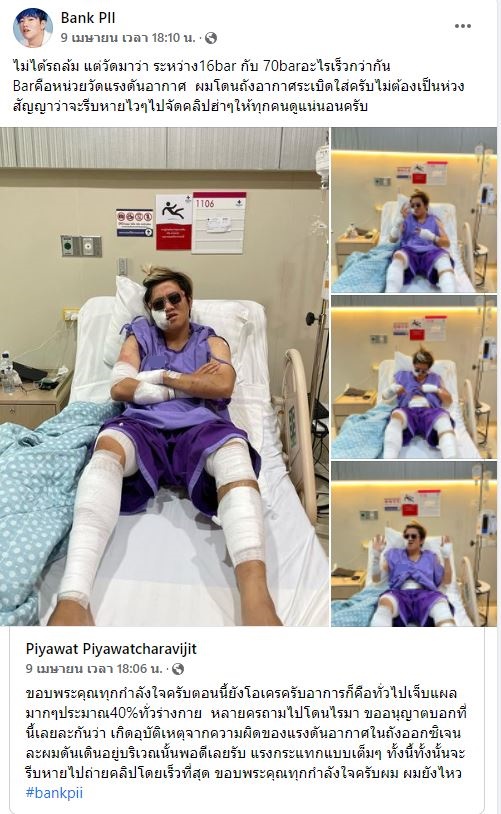 หวิดดับ! แบงค์ปิ ยูทูปเบอร์ชื่อดัง เกิดอุบัตเหตุดังอัดอากาศระเบิดใส่ 
