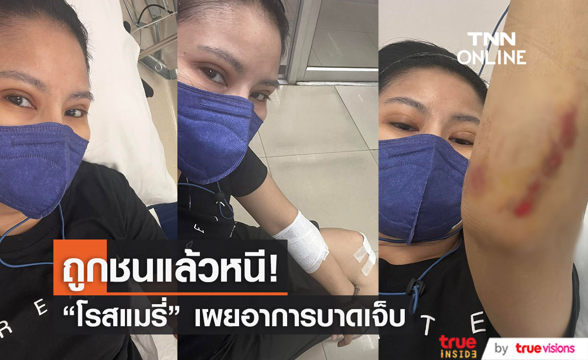 อดีตนักร้องดัง "โรสแมรี่" ถูกรถชนแล้วหนี พร้อมเผยอาการบาดเจ็บ