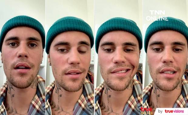 อัมพาตใบหน้าครึ่งซีก!! ‘จัสติน บีเบอร์’ แจงเหตุผลที่ต้องพักทัวร์คอนเสิร์ตกะทันหัน (มีคลิป) อัมพาตใบหน้าครึ่งซีก!! ‘จัสติน บีเบอร์’ แจงเหตุผลที่ต้องพักทัวร์คอนเสิร์ตกะทันหัน (มีคลิป)