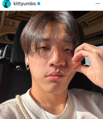 ค่ายอัปเดตอาการล่าสุด กิต หลังสูญเสียการมองเห็นตรงกลางภาพ ค่ายอัปเดตอาการล่าสุด กิต หลังสูญเสียการมองเห็นตรงกลางภาพ