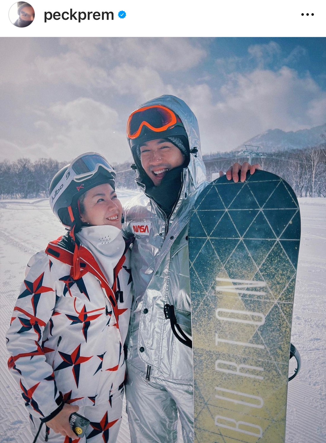 เป๊ก ยอมรับ นิว เครียดเรื่องมีลูก แต่งงาน 6 ปี ยังไร้วี่แวว