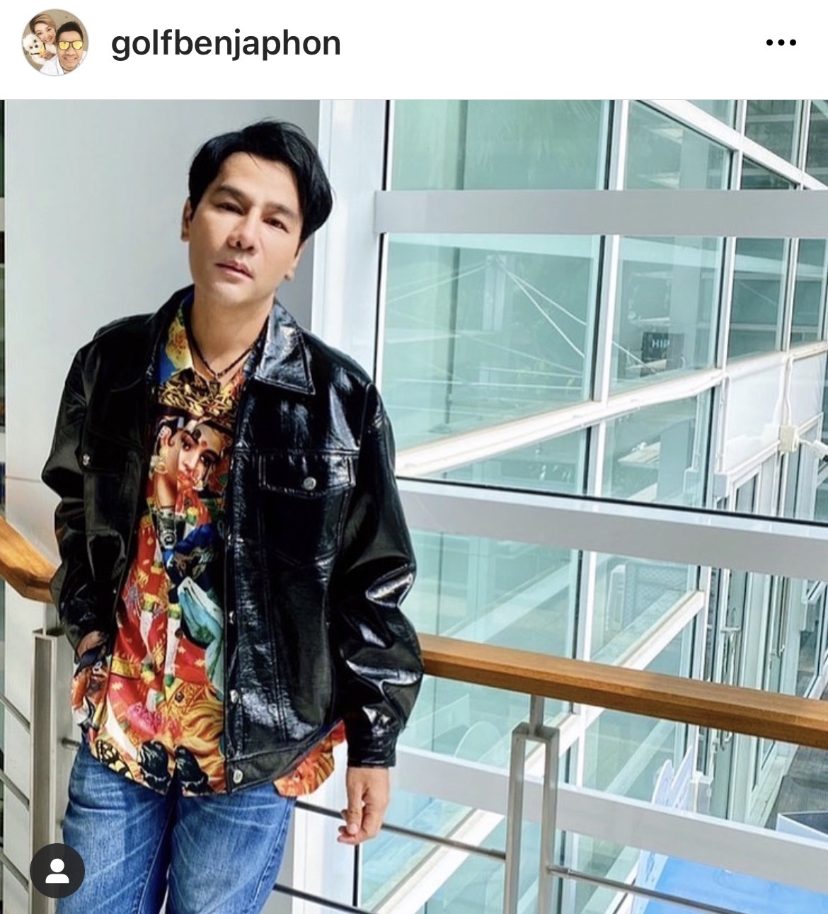 กอล์ฟ เบญจพล อัปเดตหลังเสริมหล่อ ถูกโทรศัพท์แกงหนัก จำหน้าไม่ได้?!  