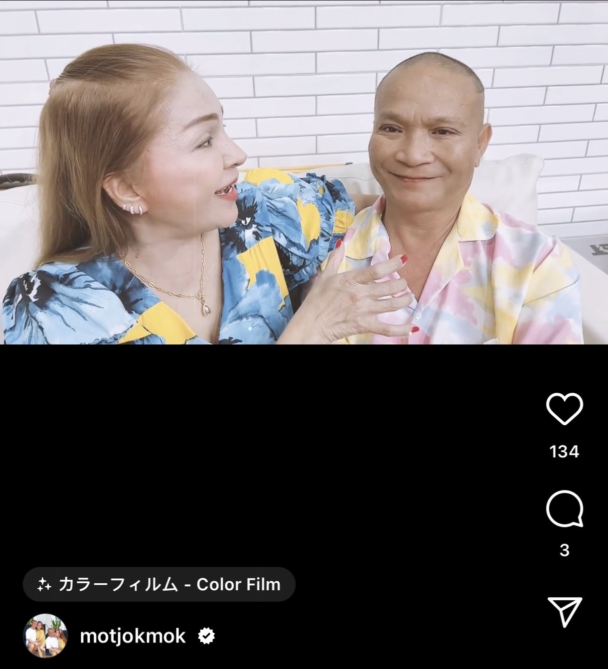 ตาหวานมาแล้ว อัปเดต หม่ำ จ๊กมก หลังตัดไหม ภรรยาแซวเหมือนศิลปินคนนี้?