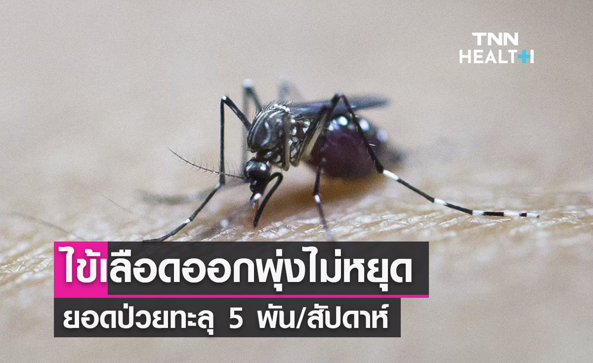 “ไข้เลือดออก” ป่วยทะลุ 5 พัน/สัปดาห์ มีอาการแบบนี้ รีบพบแพทย์วินิจฉัย