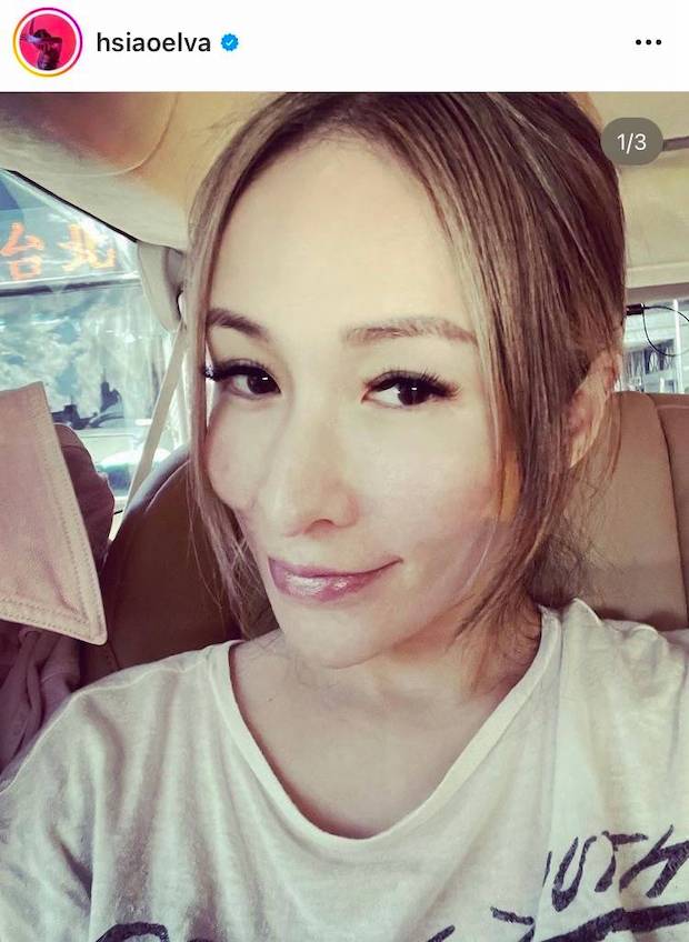 เผยหน้าสด!! ‘เอลวา เซียว’ หลังถูกสุนัขกัดที่ใบหน้ากว่า 1 ปี (มีคลิป)