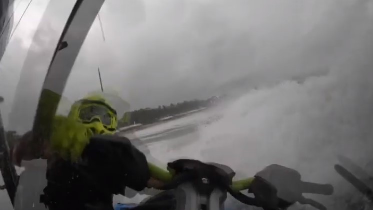 เปิ้ล นาคร ซี่โครงหักเพิ่ม 5 ซี่ รักษาตัวต่อที่บ้าน เปิ้ล นาคร ซี่โครงหักเพิ่ม 5 ซี่ รักษาตัวต่อที่บ้าน