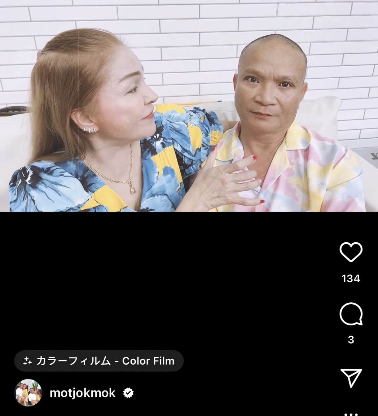 ตาหวานมาแล้ว อัปเดต หม่ำ จ๊กมก หลังตัดไหม ภรรยาแซวเหมือนศิลปินคนนี้?