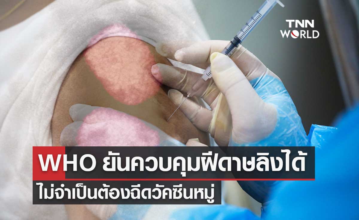 WHO ยืนยันสามารถควบคุม "โรคฝีดาษลิง" ได้ ไม่จำเป็นต้องฉีดวัคซีนหมู่