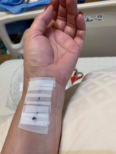 เหตุเพราะห่วง!! เบคกี้ ริสา หงษ์หิรัญ เกิดอุบัติเหตุ ลื่นล้มข้อมือหัก เหตุเพราะห่วง!! เบคกี้ ริสา หงษ์หิรัญ เกิดอุบัติเหตุ ลื่นล้มข้อมือหัก