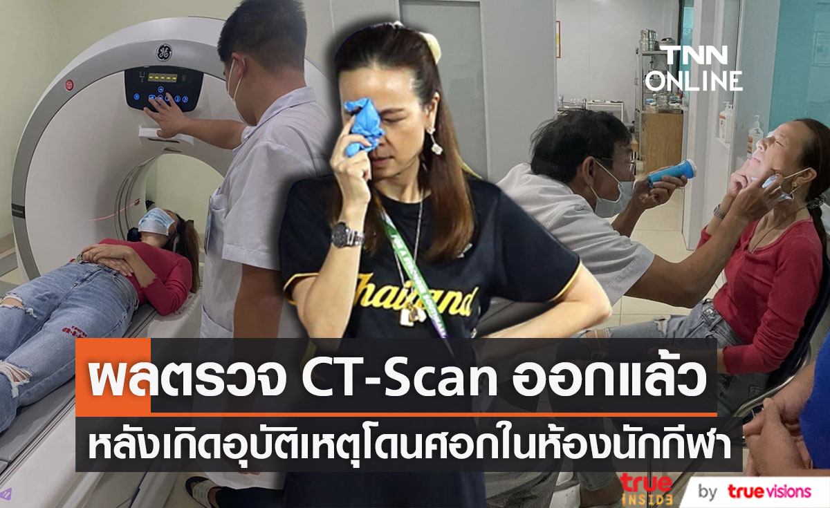 ผล CT-Scan "มาดามแป้ง" ออกแล้ว!! หลังเกิดอุบัติเหตุโดนศอกในห้องพักนักกีฬา