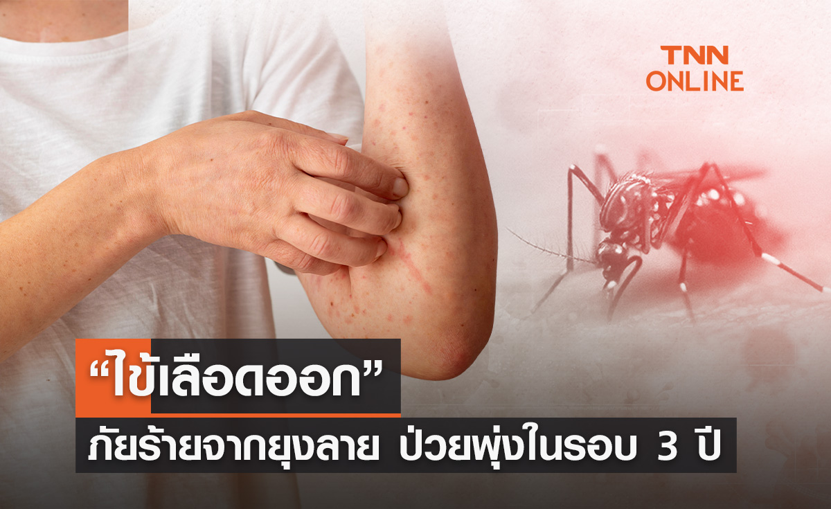 “ไข้เลือดออก” สธ.คาดมิ.ย.ปีนี้ ป่วยพุ่งสูงสุดในรอบ 3 ปี