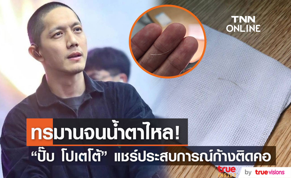 "ปั๊บ โปเตโต้" แชร์ประสบการณ์ ก้างติดคอ ต้องล้วงคอลึกมาก