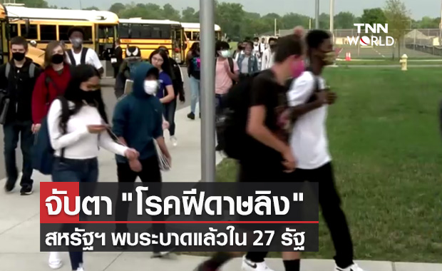 สหรัฐฯ จับตา "โรคฝีดาษลิง" ระบาดแล้ว 27 รัฐ