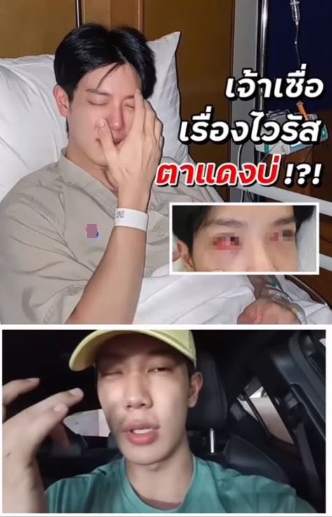 แอ็ดมิทด่วน!! เพราะเหตุนี้ เกรท สพล เผยสาเหตุเป็น ไวรัสตาแดง