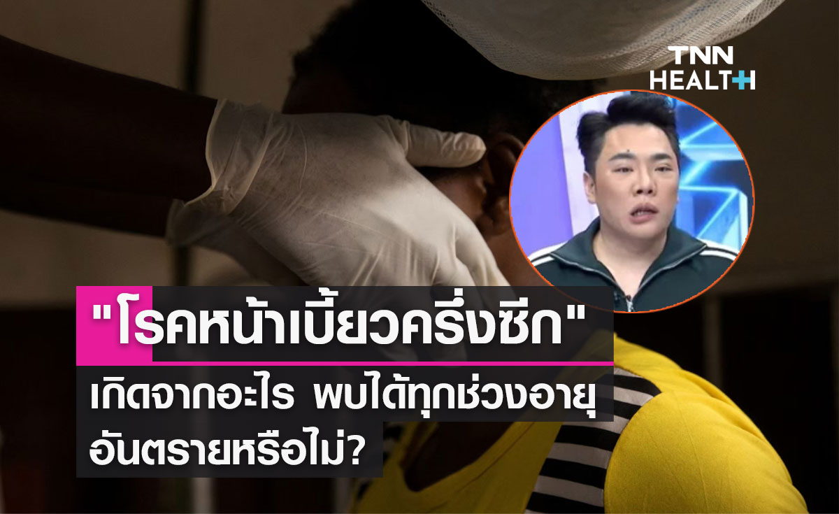 "โรคหน้าเบี้ยวครึ่งซีก" เกิดจากอะไร พบได้ทุกช่วงอายุ อันตรายหรือไม่?  