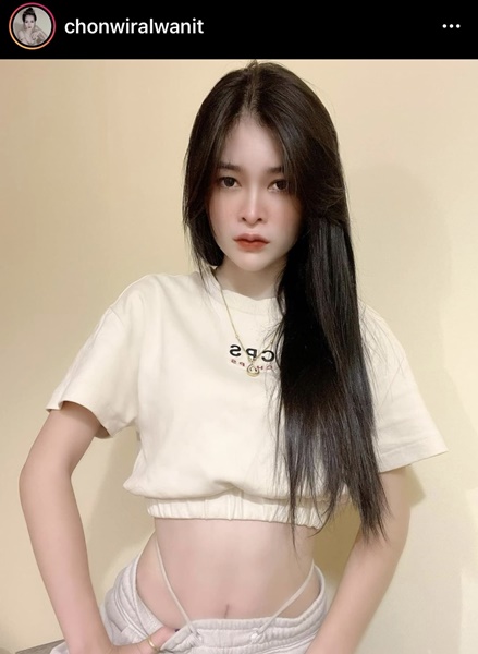 เอ๋ มิรา อัพความสวย ศัลยกรรมจมูก ตา และคาง เอ๋ มิรา อัพความสวย ศัลยกรรมจมูก ตา และคาง