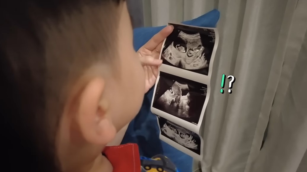 เปิดใจ บีม กวี ว่าที่คุณพ่อลูก 4 ยลโฉมเบบี๋ฝาแฝดท้อง 2 เผย ภรรยา แพ้ท้องหนัก