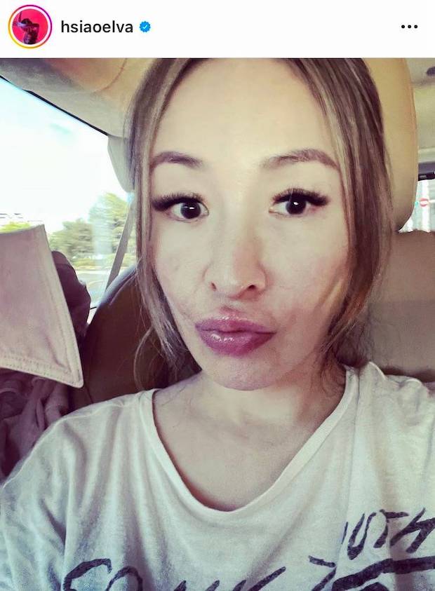 เผยหน้าสด!! ‘เอลวา เซียว’ หลังถูกสุนัขกัดที่ใบหน้ากว่า 1 ปี (มีคลิป)