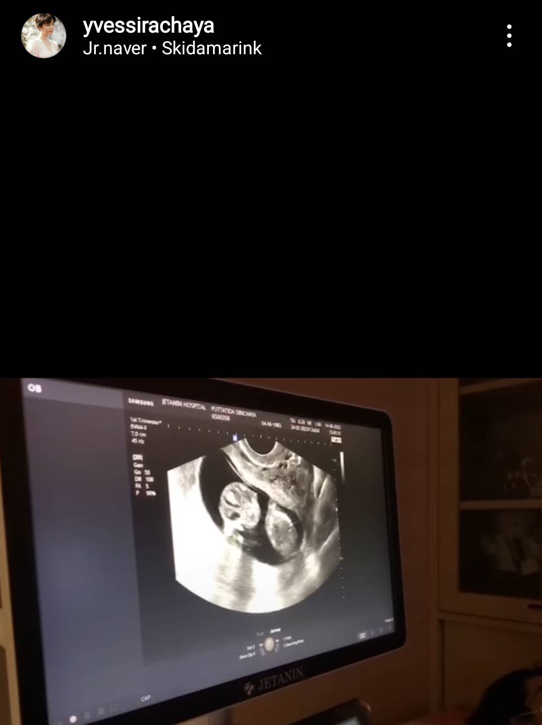 ของขวัญครบรอบ 75 ปี ที่ อีฟ พุทธธิดา มอบให้ แม่เปี๊ยก