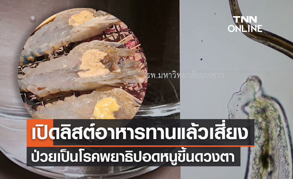 เปิดลิสต์อาหารเสี่ยง "พยาธิปอดหนูขึ้นตา" รายล่าสุดเพราะ “กุ้งแช่น้ำปลา”เป็นเหตุ