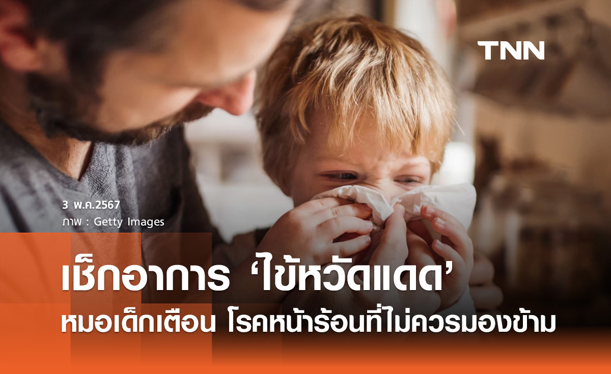 ไข้หวัดแดดในเด็ก! โรคหน้าร้อนที่ไม่ควรมองข้าม เช็กอาการ-วิธีป้องกันที่นี่