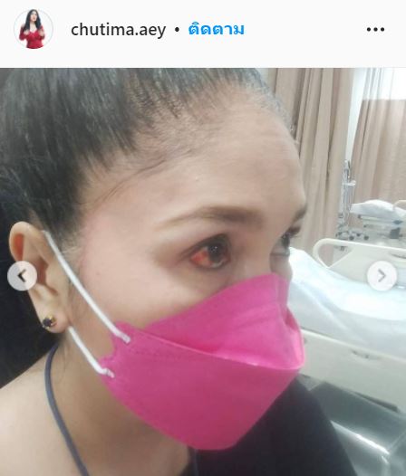 เกิดอุบัติเหตุ!! เอ้ ชุติมา รถเบรกกะทันหัน เล็บทิ่มลูกตา