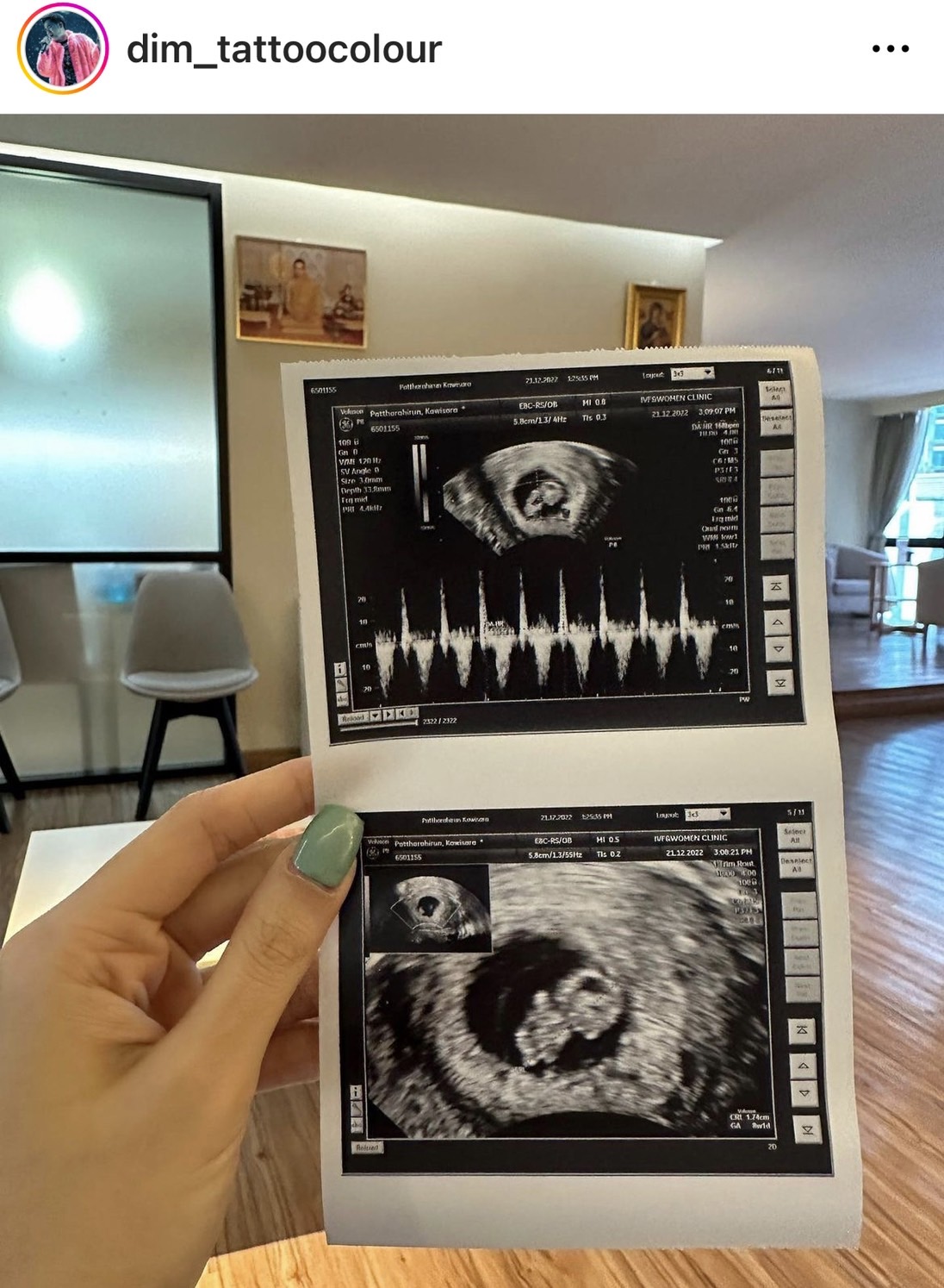 “ดิม Tattoo Colour” เฮลั่น! มีข่าวดี เบบี๋มาแล้ว เป็นของขวัญต้อนรับปีกระต่าย