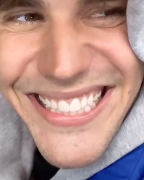 ดีขึ้นมาก!! 'จัสติน บีเบอร์' ยิ้มกว้างอัปเดตอาการอัมพาตใบหน้าครึ่งซีก ดีขึ้นมาก!! 'จัสติน บีเบอร์' ยิ้มกว้างอัปเดตอาการอัมพาตใบหน้าครึ่งซีก