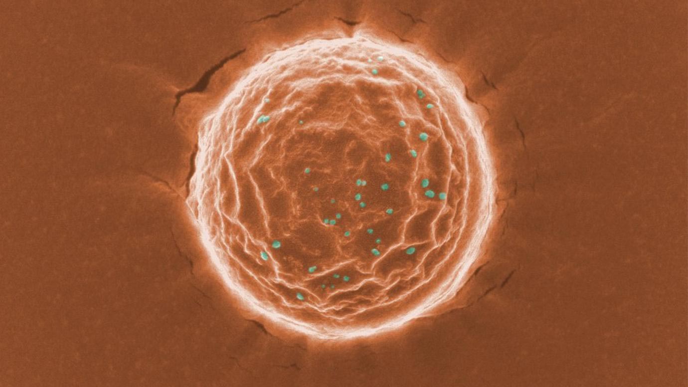 นักวิจัยคิดค้น กับดักไวรัส ทางเลือกใหม่ในการรักษา COVID-19 นักวิจัยคิดค้น กับดักไวรัส ทางเลือกใหม่ในการรักษา COVID-19