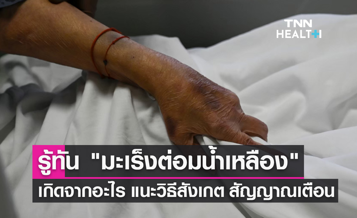 "มะเร็งต่อมน้ำเหลือง" เกิดจากอะไร? แนะวิธิสังเกต ภัยเงียบที่ไม่ควรมองข้าม