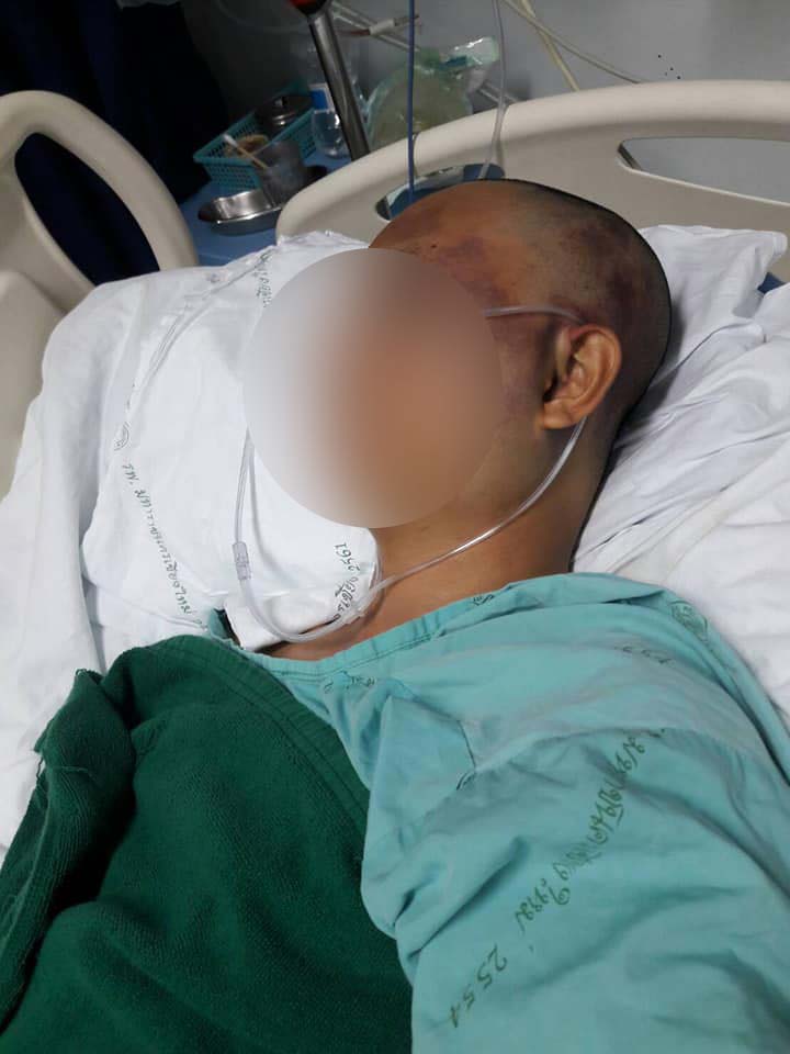 หนุ่มแชร์เรื่องสุดบีบหัวใจกำลังไปเป็นเชฟที่เมืองนอก แต่อนาคตดับเพราะกระบะซิ่ง หนุ่มแชร์เรื่องสุดบีบหัวใจกำลังไปเป็นเชฟที่เมืองนอก แต่อนาคตดับเพราะกระบะซิ่ง