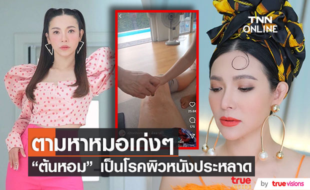 ต้นหอม เป็นโรคผิวหนังประหลาด หมอตัดชิ้นเนื้อไปวิจัย แต่ยังไม่รู้สาเหตุ