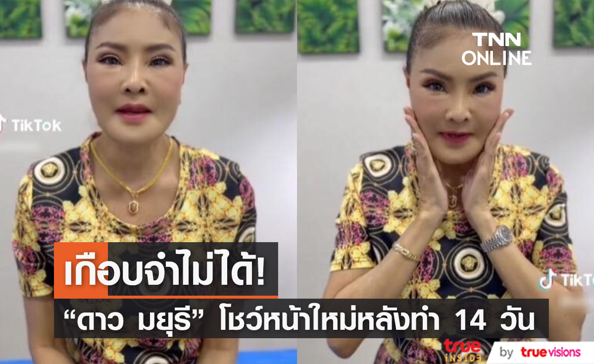 ตะลึงความสวย! "ดาว มยุรี" อัปเดตหน้าใหม่หลังทำศัลยกรรมครบ 14 วัน (มีคลิป)