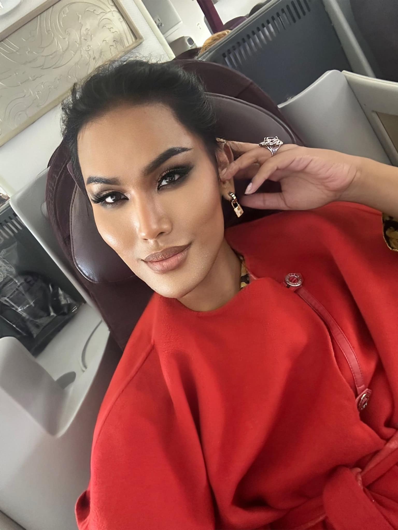 ผู้เสียหายร้อง DSI ตรวจสอบเส้นทางการเงิน แอนนา ทีวีพูล ป่วยเพราะศัลยกรรม