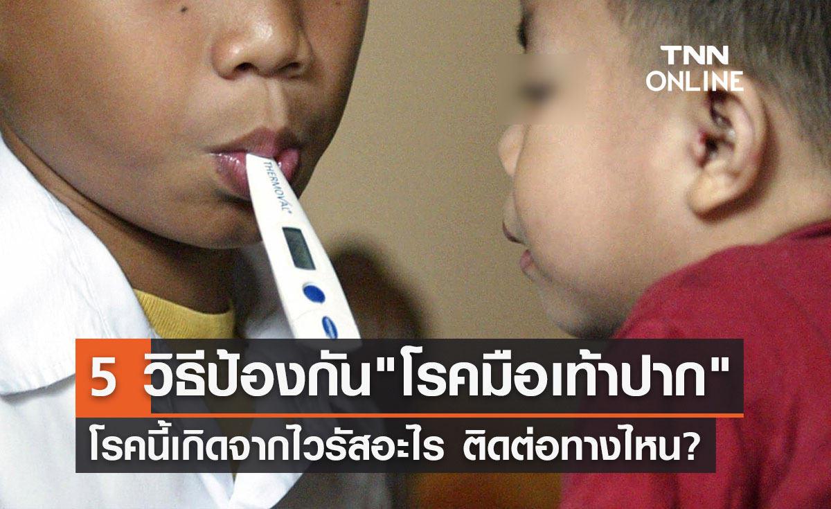 "โรคมือเท้าปาก" ระบาดอีกแล้ว! หมอแล็บฯแนะวิธีป้องกัน 5 ข้อ