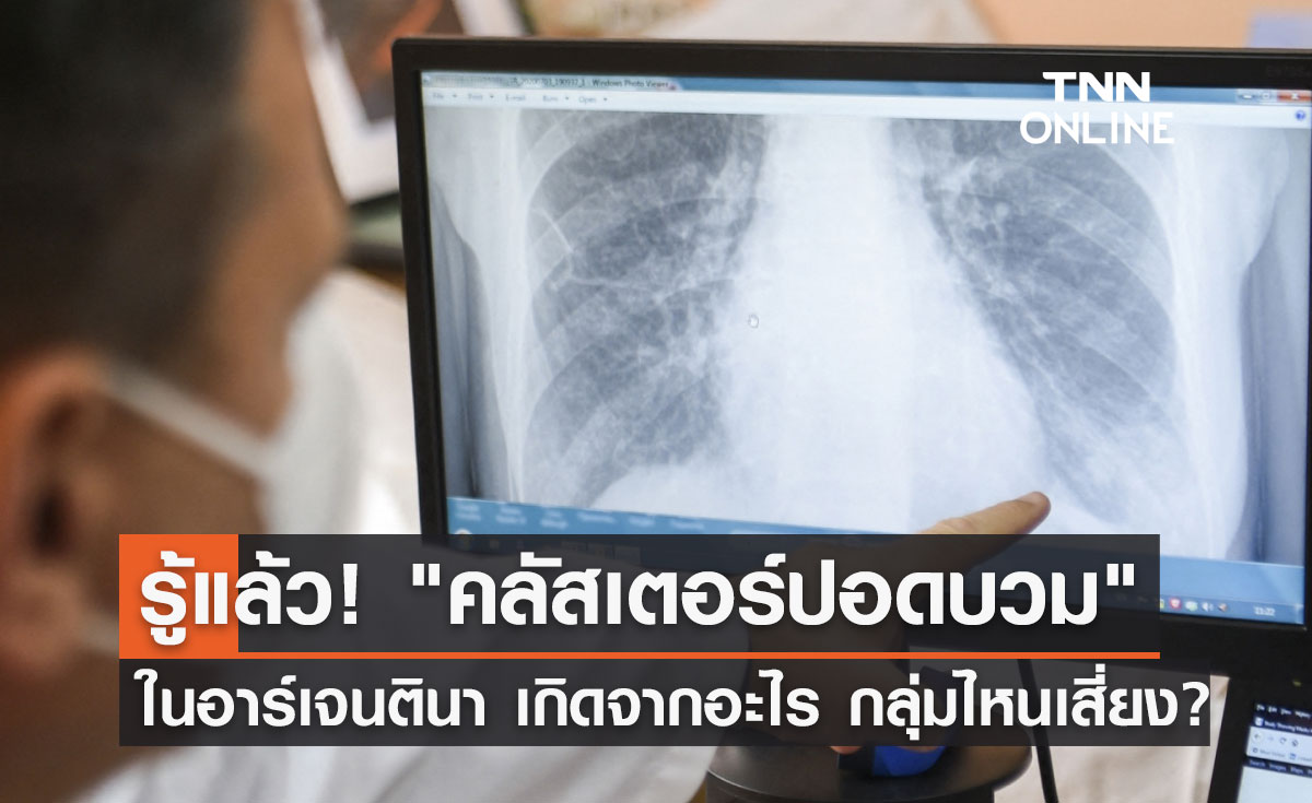 รู้แล้ว "คลัสเตอร์ปอดบวม" ในอาร์เจนตินา เกิดจากอะไร กลุ่มไหนเสี่ยง?