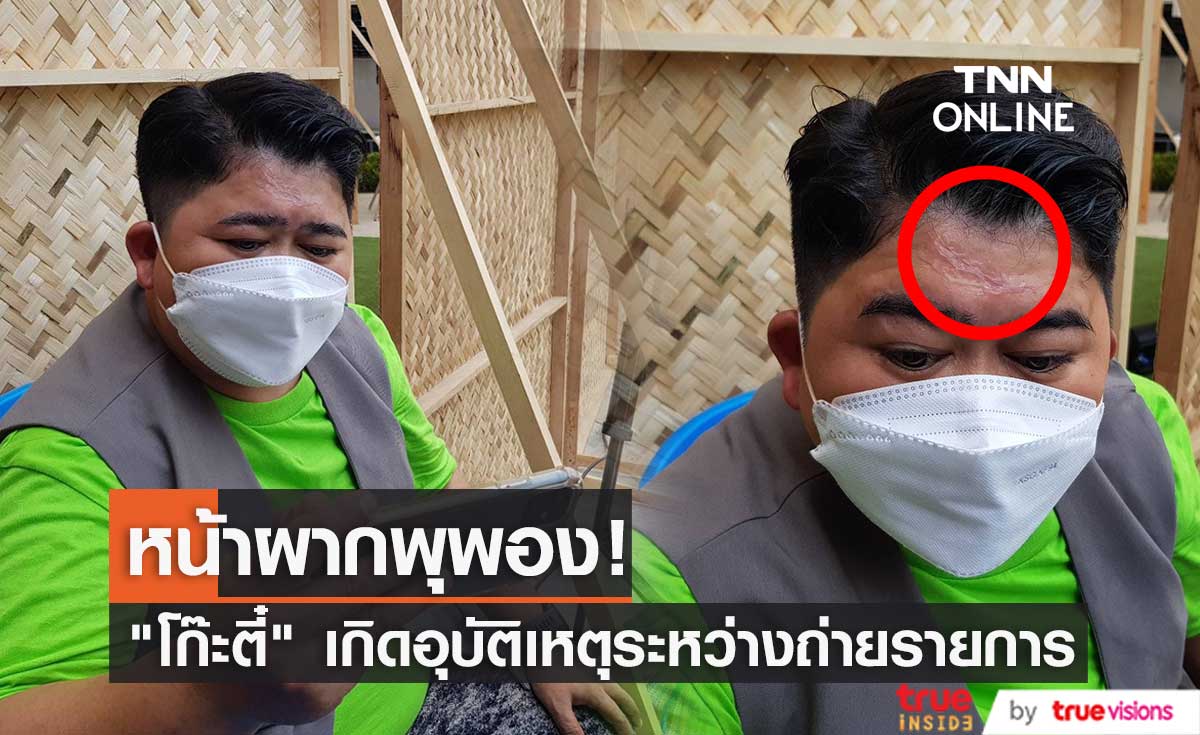 "โก๊ะตี๋" เกิดอุบัติเหตุ หน้าผากพุพอง จากโดนฝาซึ้งร้อน ๆขณะถ่ายรายการ (มีคลิป)