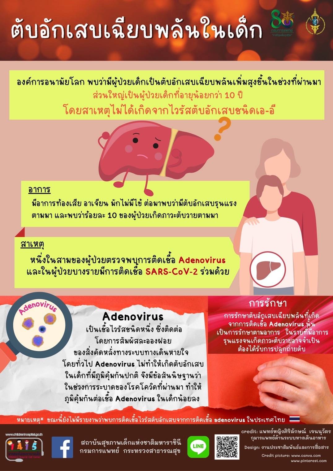 เฝ้าระวังโรคตับอักเสบในเด็กต่ำกว่า 10 ปี พร้อมเผย 7 อาการของโรคเป็นอย่างไร