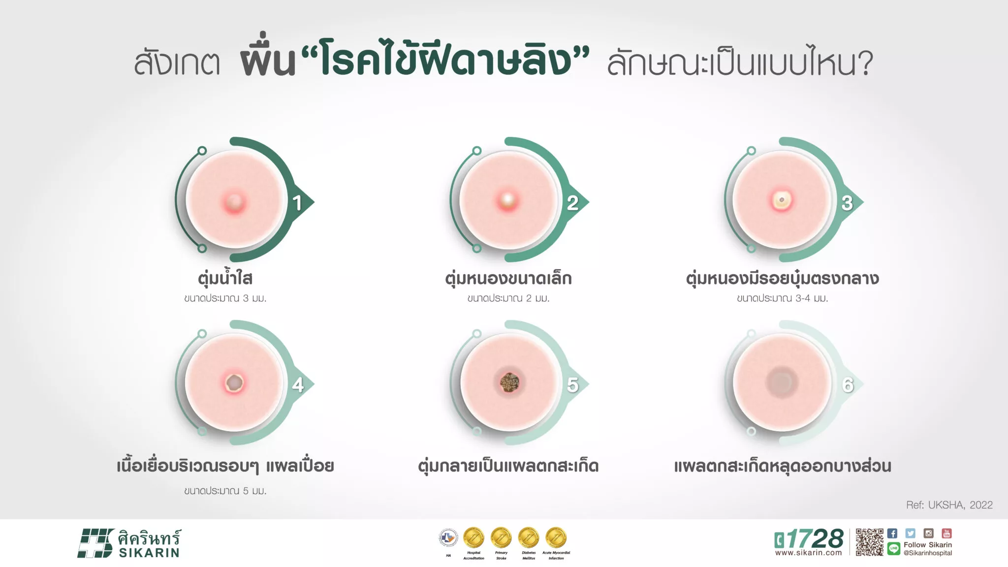 กอดจูบ ติดเชื้อฝีดาษลิงได้หรือไม่? ผื่นแบบใดที่ต้องระวัง เช็กเลย