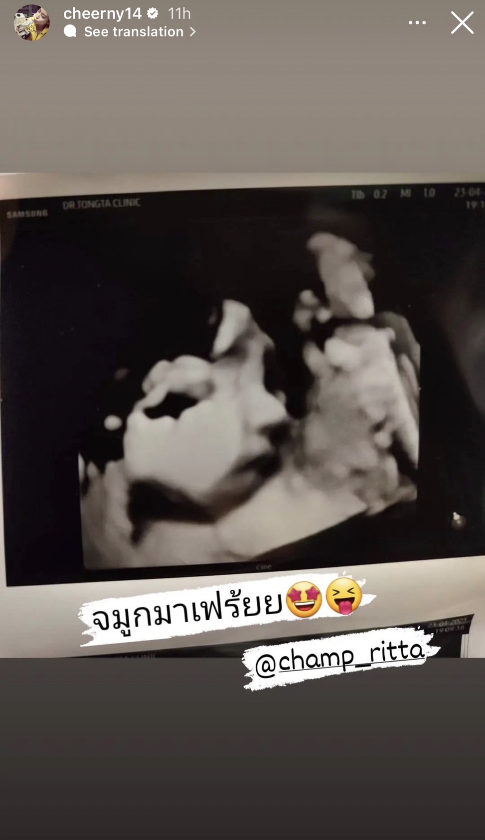 เชียร์ ฑิฆัมพร โพสต์ประกาศข่าวดี ต้อนรับสมาชิกใหม่ของครอบครัว!