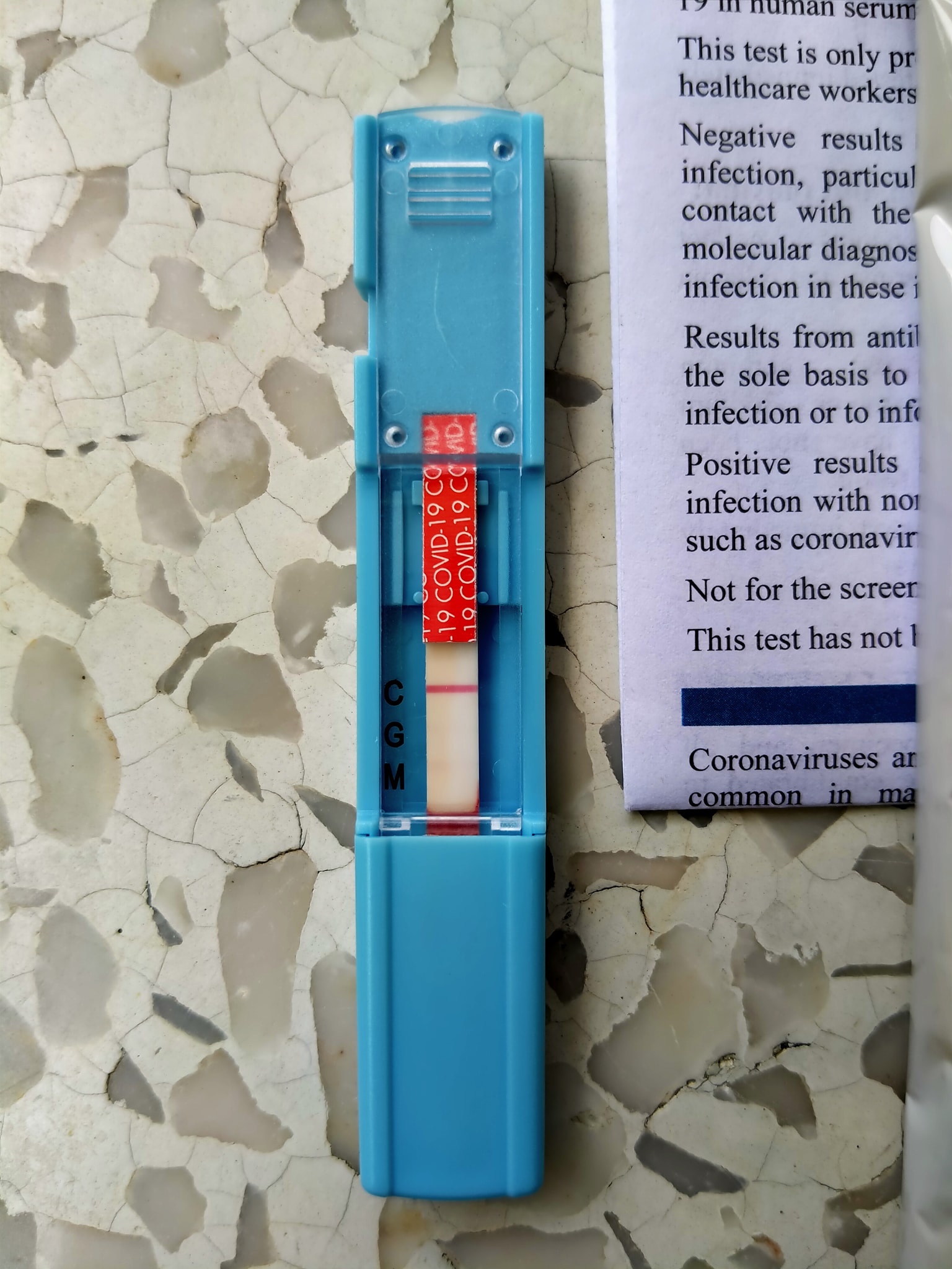 อ.เจษฎารีวิว ‘ชุดตรวจโควิดเร่งด่วน’ ยังไม่ยืนยันแต่ใช้ง่ายมาก อ.เจษฎารีวิว ‘ชุดตรวจโควิดเร่งด่วน’ ยังไม่ยืนยันแต่ใช้ง่ายมาก