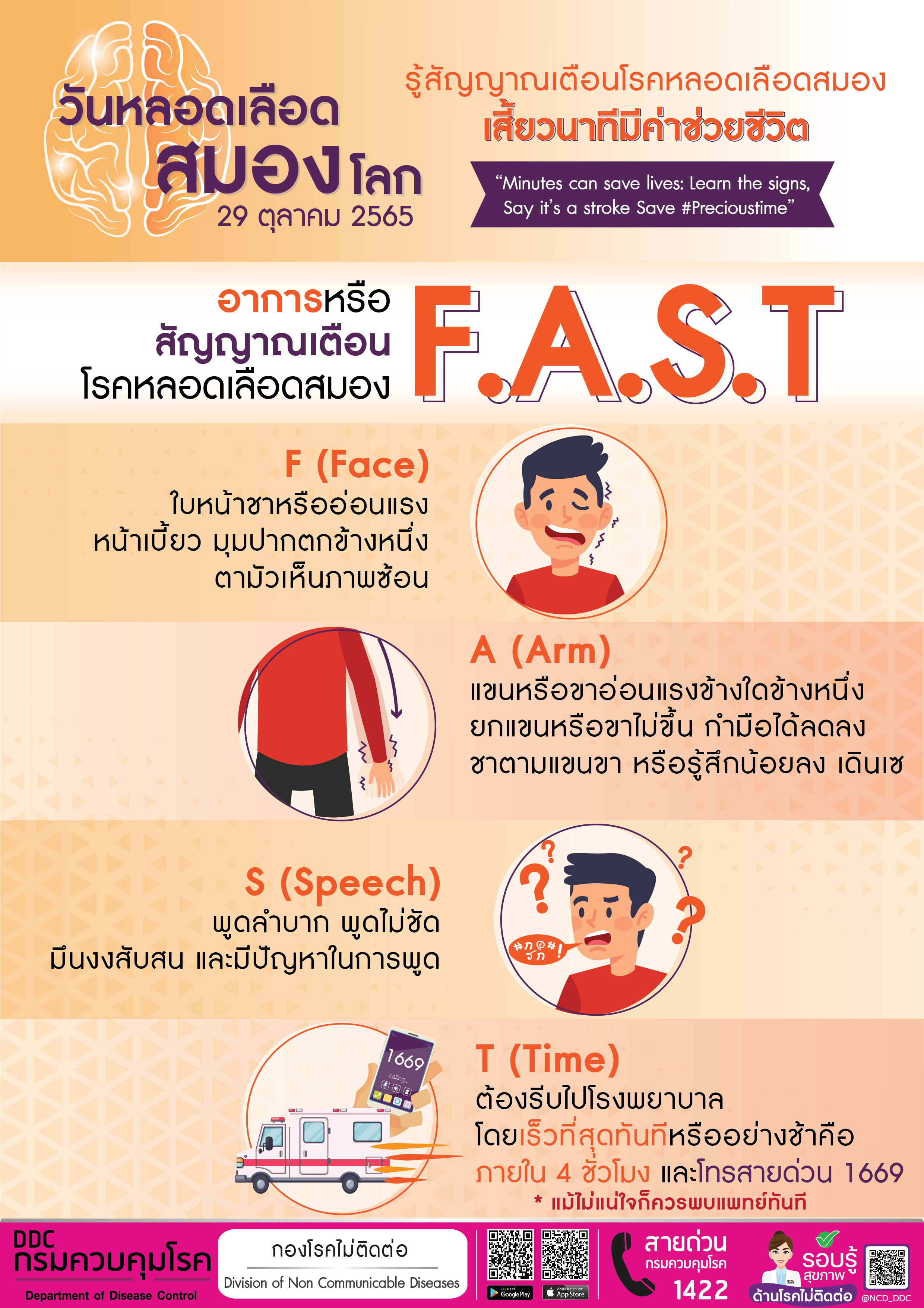 โรคหลอดเลือดสมอง ปัจจัยเสี่ยงเกิดจากอะไร-มีอาการเหล่านี้ต้องระวัง!
