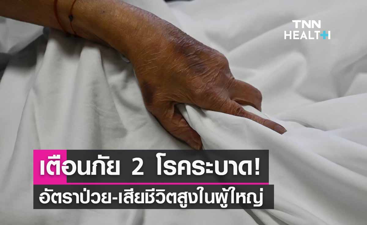 เตือนภัย 2 โรคระบาด! อัตราป่วย-เสียชีวิตสูงในผู้ใหญ่ ไข้เกิน 2 วัน รีบพบแพทย์
